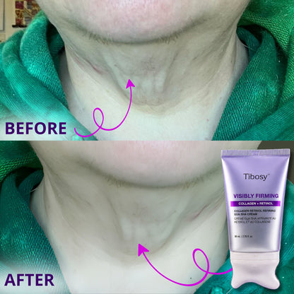 Tibosy™ Collagen Retinol Guasha Cream