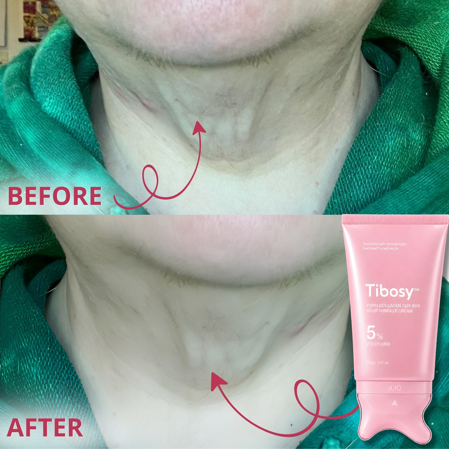 Tibosy™ Collagen Neck Wrinkle Gua Sha Cream