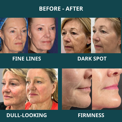 Tibosy™ Total Package Serum