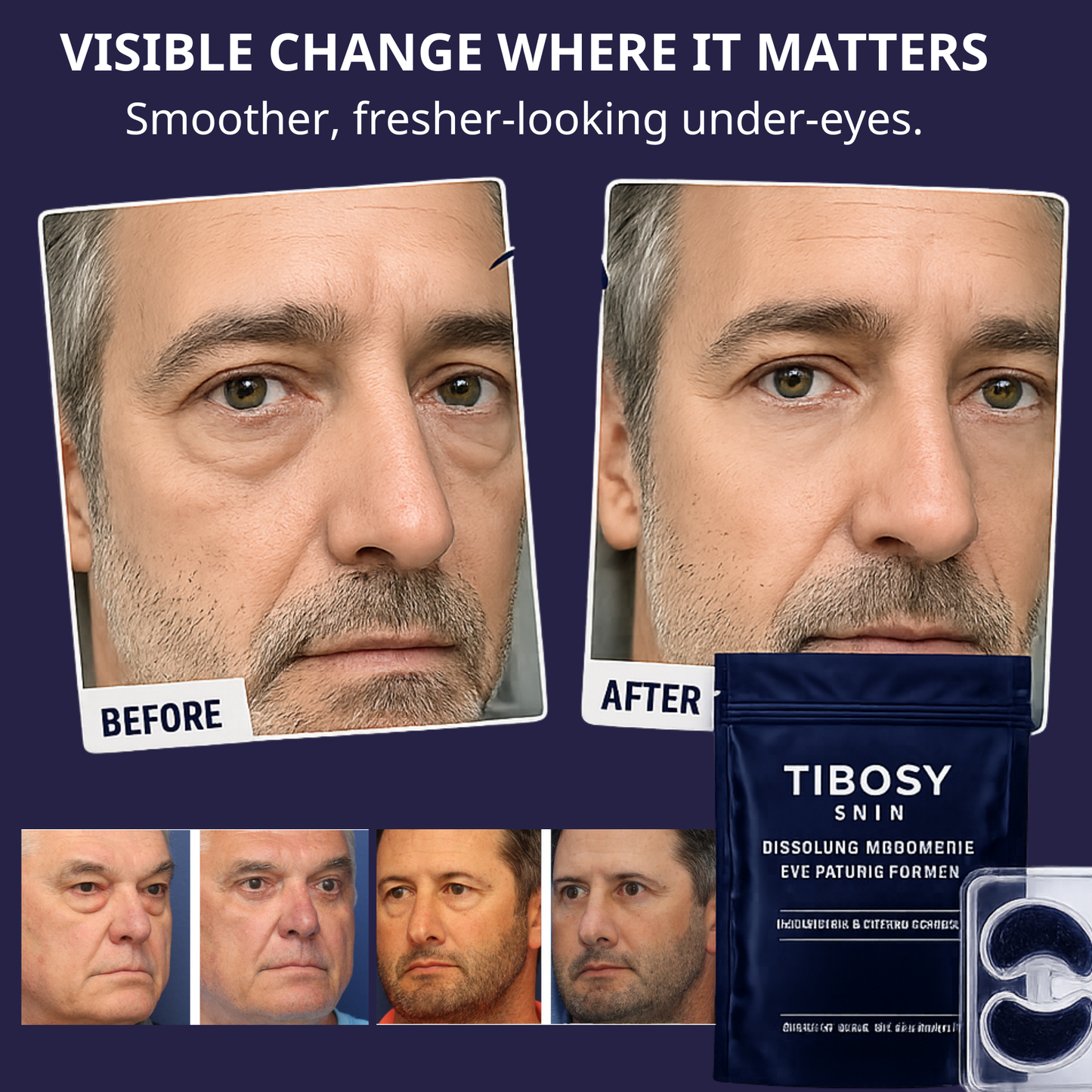 Tibosy™ Under-Eye Repair Patches